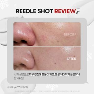 سرم میکرونیدلینگ ریدل شات VT Reedle Shot