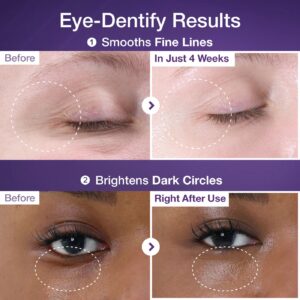 کرم دور چشم نامبوزین شماره ۹ حاوی NAD+ و رتینول حجم ۱۰ میل ضد چروک و روشن کننده