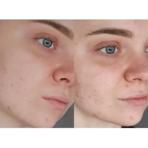 کرم لیفت کننده قوی و ضد چروک رتینول شات سلیمکس Slimix | اصل